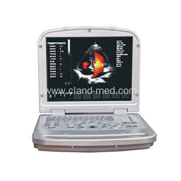 High Quality Laptop 4d Portable Color Doppler Ultrasound Machine